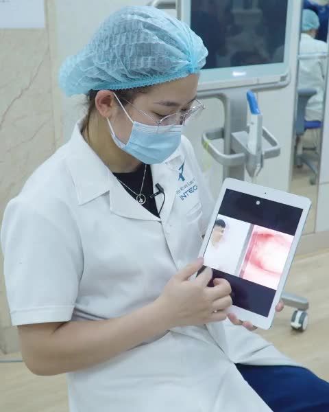 Quá trình gắn mắc cài kim loại tự buộc tại Nha khoa Paris - Chi Nhánh Nghệ An.